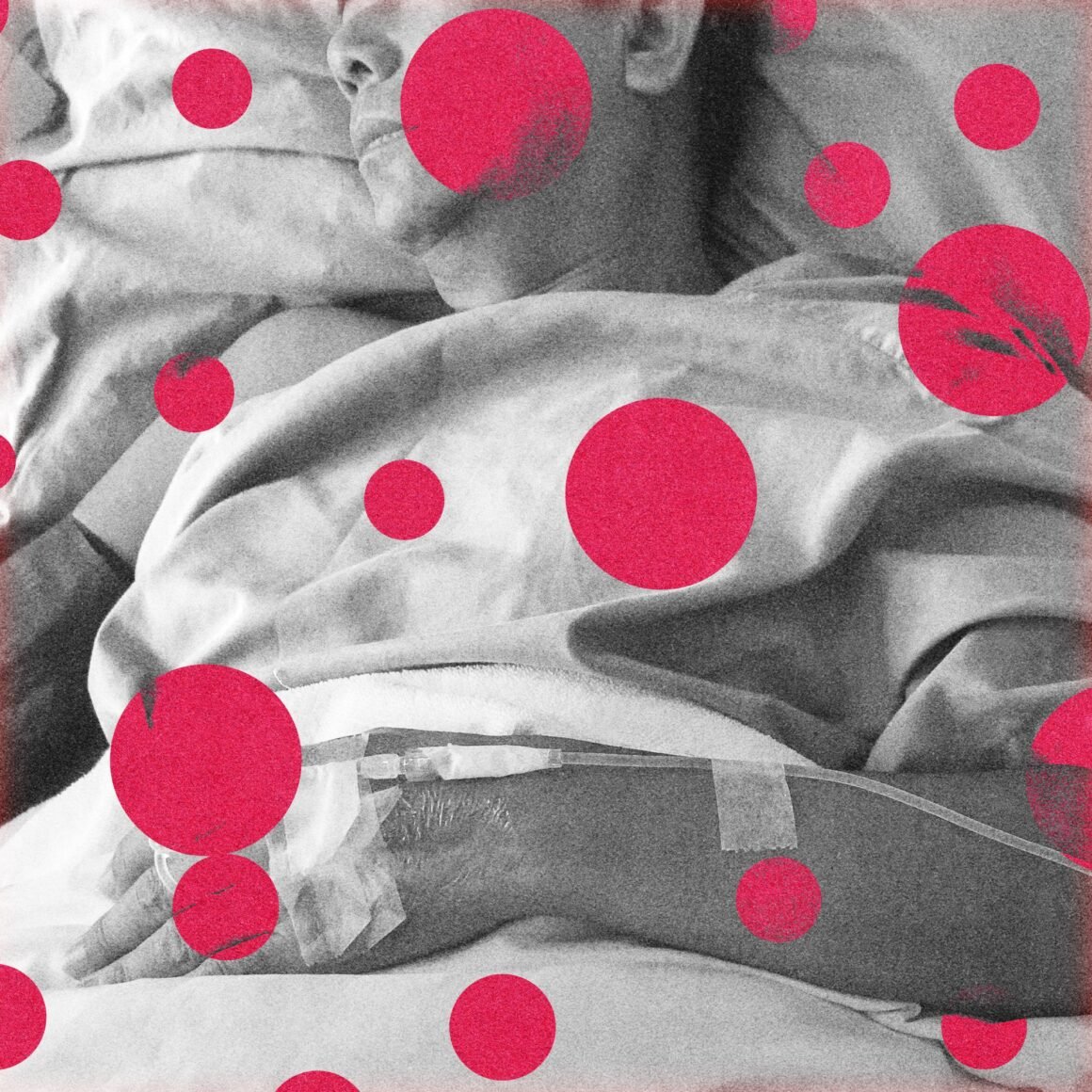 The US Just Recorded Its First 2 Measles Deaths This Year